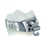 BANDA PARA MOLAR MBT