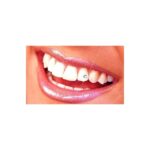 STRASS PIERCING DENTAL X UNIDAD